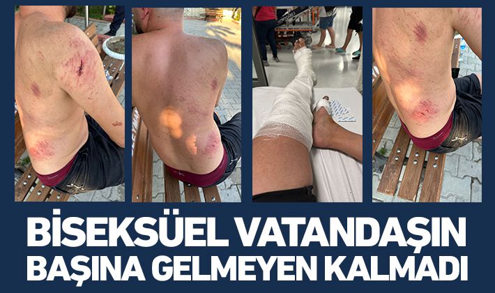 BİSEKSÜEL VATANDAŞIN BAŞINA GELMEYEN KALMADI