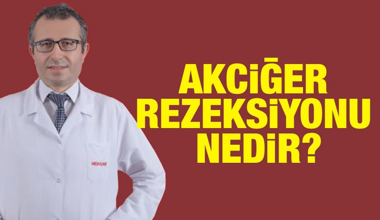 AKCİĞER REZEKSİYONU NEDİR?