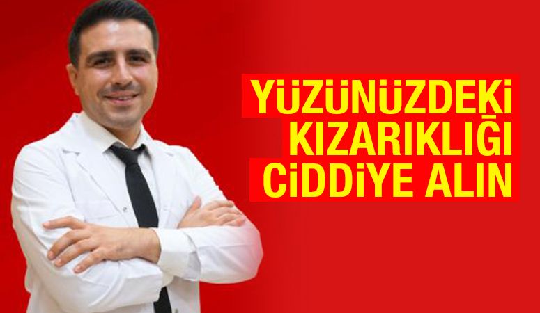 Yüzünüzdeki kızarıklığı ciddiye alın 